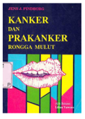 Kanker dan Prakanker Rongga Mulut