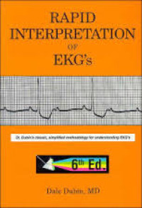Rapid Interpretation of EKG's Ed.6
