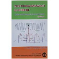 Elektrokardiografi Ilustratif: belajar EKG dengan ilustrasi sederhana