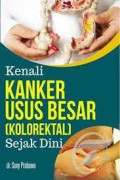 Kenali Kanker usus Besar (kolorektal) Sejak Dini