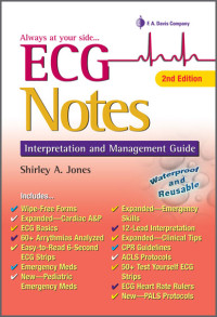 ECG Notes