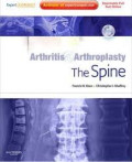Arthritis & Arthroplasty The Spine