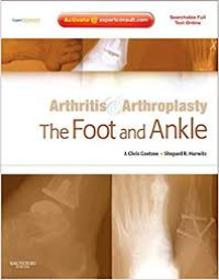 Image of Arthritis & Arthroplasty The Foot and Ankle